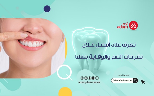 تعرف على أفضل علاج تقرحات الفم والوقاية منها